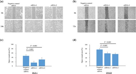 wound healing assay cancer